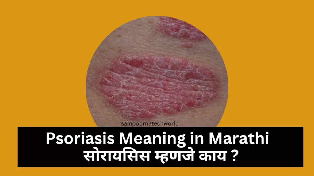 Psoriasis Meaning in Marathi