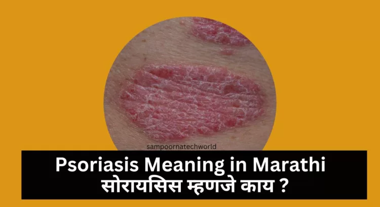 Psoriasis Meaning in Marathi